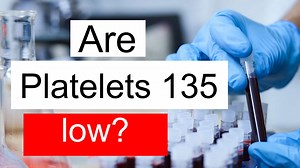 Is Platelet count 135 low, normal or dangerous? What does Platelet count level 135 mean?