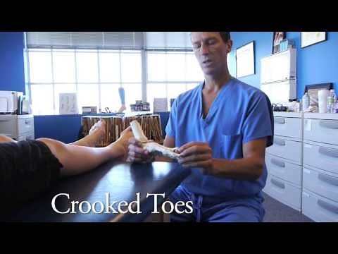 Spread Your Toes™ Series: Crooked & Overlapping Toes, Conservative Care vs. Conventional Care