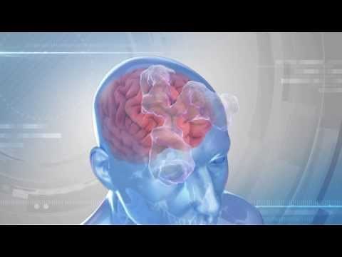 Brain Shuttle Transports Antibodies into the Brain over the Blood-Brain Barrier