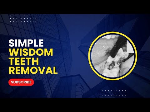 Upper Wisdom Tooth Removal | Atraumatic Dental Extraction Procedure