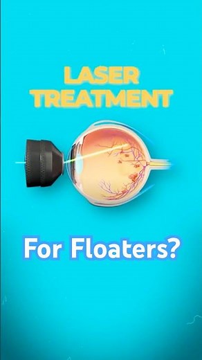 Can You Get Rid of Eye Floaters? 2 Real Treatments Explained