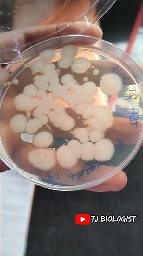 TSA agar | culture medium | microbiology | bacteria | yeast, mold | #biology #science #Tjbiologist