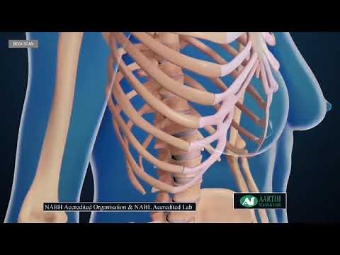 Dexa Scan Explained in detail