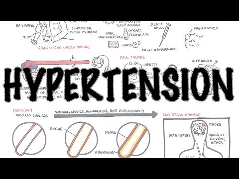 Hypertension - Overview (causes, pathophysiology, investigations, treatment