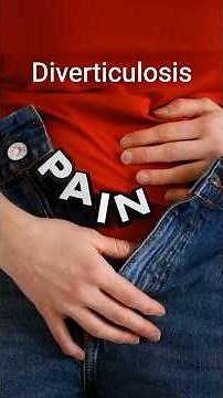 Causes and best treatment of diverticulosis