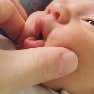 9.4K views · 394 reactions | How To Get Beautiful CHEEKBONES With Face Massage <3  @sevdetubaarikan | Living The Mom Life | Facebook