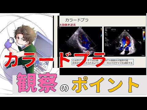 【心エコー】カラードプラはどう使う？ルーチンで即使えるポイント総まとめ！