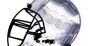 Degenerative Brain Disease Found In 87% of Former Football Players: Study