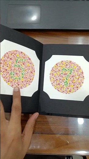 Colour Vision Test Understanding Colour Blindness Test #colorblindness #eyehospital #eyedoctor