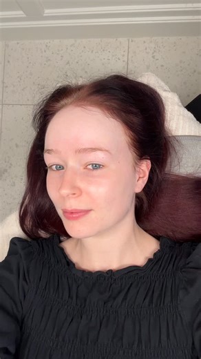 ✨ Mesoterapi – 1 måned senere ✨ For en måned siden lavede vi første behandling, og i dag var @f.bermann til opfølgning 💛 Huden har allerede fået mere glød, jævnhed og spændstighed – og nu går vi et step dybere for at stimulere endnu mere fornyelse og fugt 🌿 Mesoterapi er en aktiv og effektiv behandling, hvor små nåle kombineres med fugt, vitaminer og antioxidanter, der arbejdes direkte ned i huden. Resultatet er en sund, gennemfugtet og naturlig hudforbedring – helt uden filter 💧 ⸻ 🌟 Novembe