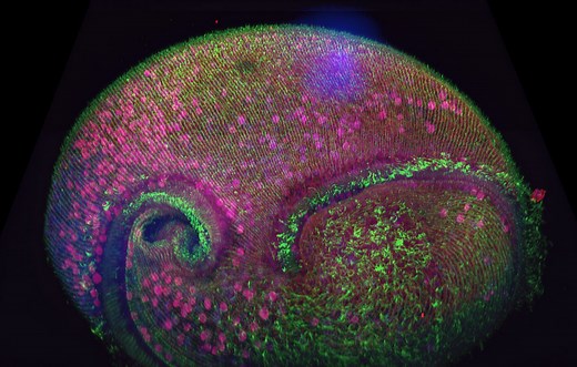 Overview of Microscopy Techniques: Confocal, Widefield, Transmitted Light and Deconvolution