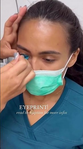 EyePrint PRO Scleral Lens