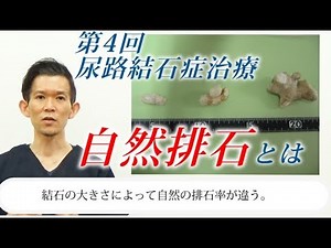 尿路結石（尿管結石）、自然排石とは