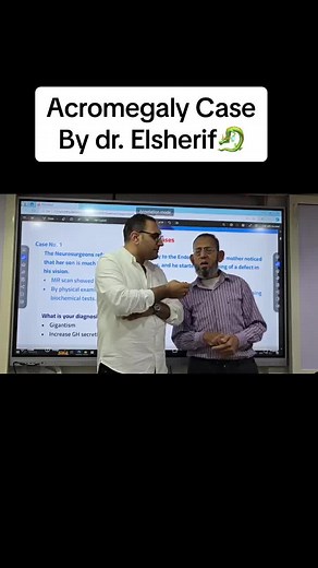 Understanding Acromegaly: A Physiology Case by Dr. Elsherif🐉🔥