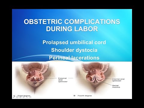 Obstetric complications during labor