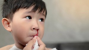Ex-paramedic warns common nose bleed mistake could prove dangerous