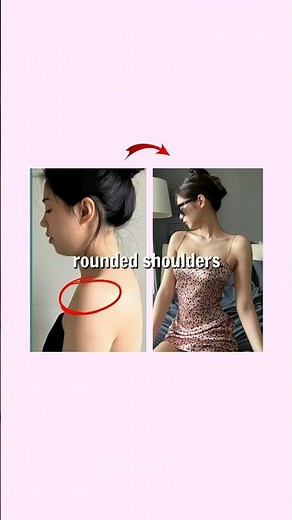 😳Do THIS Against a Wall — Posture Changes Fast💡Genius Posture Exercises