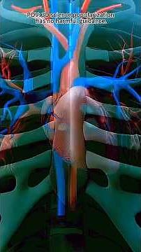 How Open Heart Surgery is Performed ❤️ |