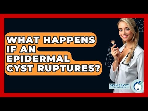 What Happens If An Epidermal Cyst Ruptures? - Skin Savvy Dermatology