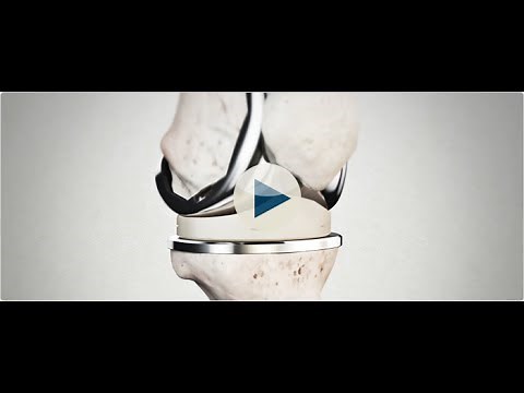 Attune Knee System