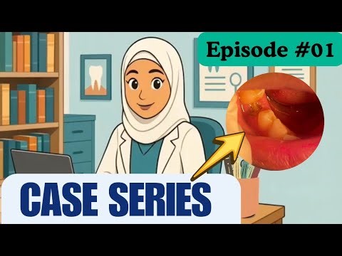 Case Series Episode #01 // Case of DRY SOCKET