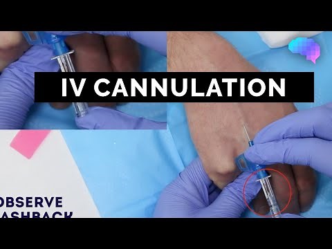 Intravenous (IV) cannulation | OSCE Guide | UKMLA | CPSA | PLAB 2