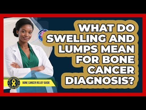 What Do Swelling And Lumps Mean For Bone Cancer Diagnosis? - Bone Cancer Relief Guide