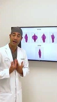 Labiaplasty with Dr. Zuri in Miami | Zuri Plastic Surgery
