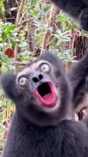 Laser beams for the burnout?