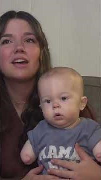 Baby born with no limbs get prosthetic legs