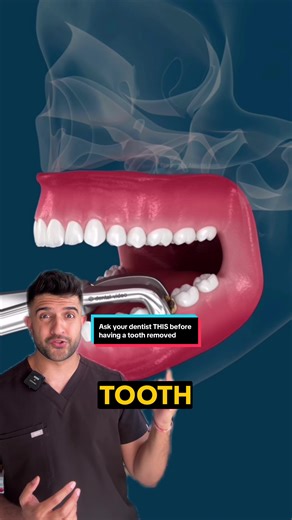 Understanding Bone Grafts in Tooth Extraction