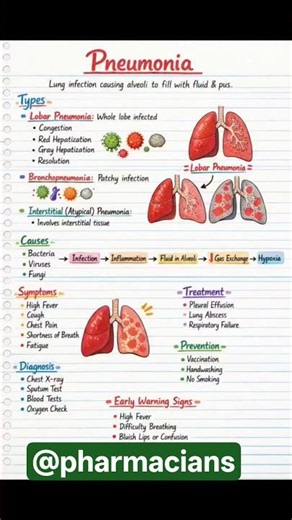 Pneumonia|Types| symptoms| Diagnosis| treatment| precautions | Early warning signs