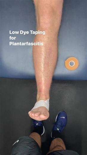 20K views · 203 reactions | Low Dye Taping for Plantarfacitis #theclubphysio #physio #physiotherapy #plantarfascia #heelpain #ankle #footpain #plantarfasciitis #taping #injuryprevention #injury #sportstaping #strapping | The Club Physio | Facebook