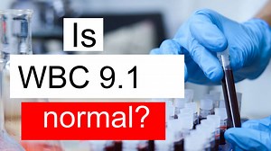 Is WBC 9.1 normal, high or low? What does White blood cell count level 9.1 mean?