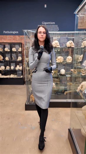 The Bone Museum on Instagram: "Thoracopagus twins are the most common form of conjoined twinning, joined at the chest and often sharing vital organs such as the heart and liver. Because their anatomy is so closely intertwined, each case offers rare insight into human development. Conjoined twinning happens very early in pregnancy, around 13–15 days after fertilization, when the developing embryo begins to form the body plan. The leading theory is that the embryo partially splits but does not ful