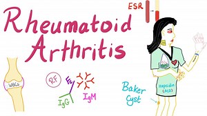 Rheumatoid Arthritis (Part 3) | Medicosis Perfectionalis