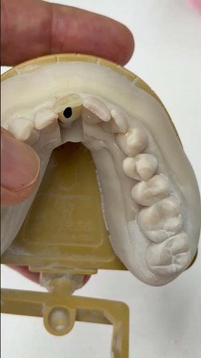 This looks like a real tooth...