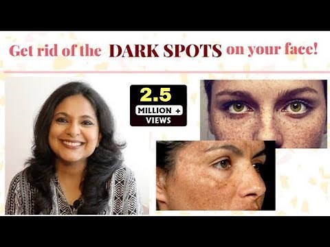 Best Remedies for Hyperpigmentation in 5 minutes - Dermatologist Solutions - #Zindagi_With_Richa