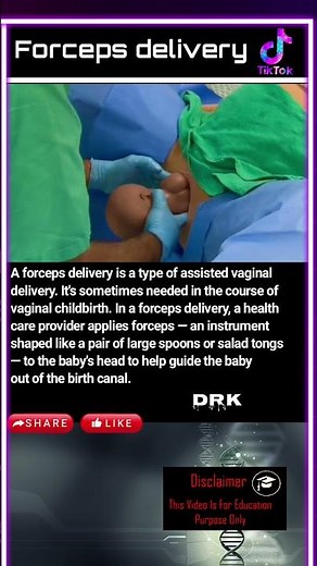 Forceps delivery