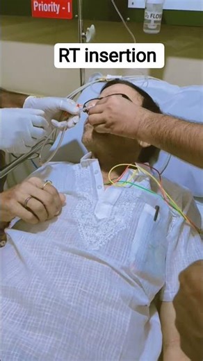 Right way of Ryle tube insertion #nursing #shorts