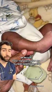 Pigment Not Coming In? Doctor Explains