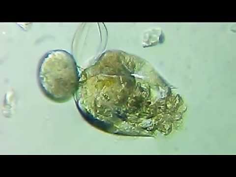 シオミズツボワムシ (4) 形態・内部構造