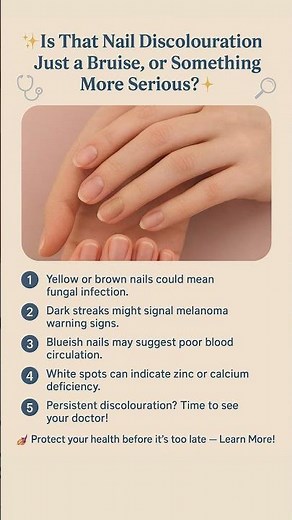 Is That Nail Discoloration Just a Bruise, or Something More Serious #shorts #trending #viral