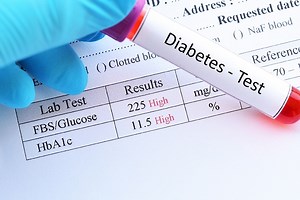 Mahasiswa Ini Temukan Inovasi Alat Sensor Kadar Gula Darah Diabetes : Okezone Edukasi