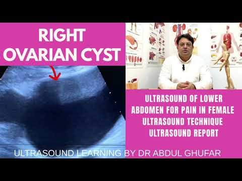 Ovarian cyst ultrasound | Ovarian ultrasound normal vs abnormal image appearance | Pelvic ultrasound