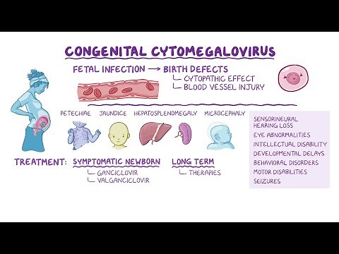 Congenital Cytomegalovirus (CMV): Causes, Symptoms & Impact