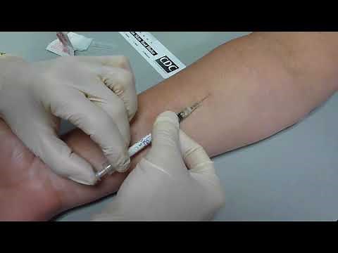 Tb Skin Test Placement