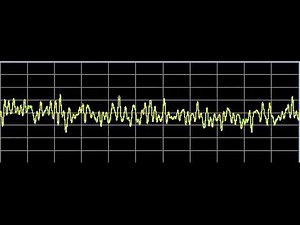 Metabolism Repair - Rife Frequencies