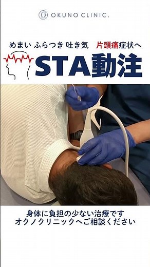 片頭痛に「STA動注」の治療風景｜1〜2分で血管にアプローチ　Migraine Injection in Action: STA Arterial Therapy (1-2 min)