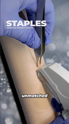 When Are Staples BETTER Than Sutures⁉️
